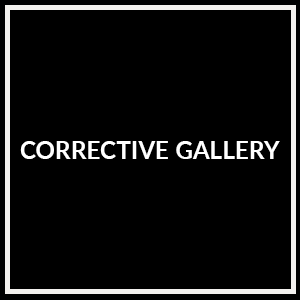 corrective gallery